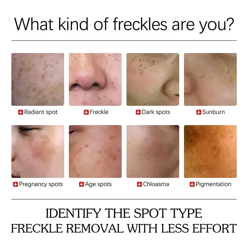 Dark Spot Removal Serum Effectively Lightens and Diminishes Dark Spots Smoothen & Refines the Skin'S Texture Moisturizing Repair